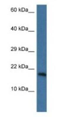 Western Blot: PNKD Antibody [NBP1-74205]