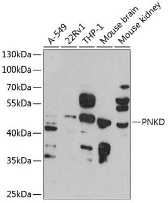 Western Blot: PNKD AntibodyBSA Free [NBP3-04617]