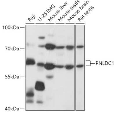 Western Blot: PNLDC1 AntibodyAzide and BSA Free [NBP2-94424]