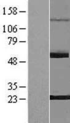 Western Blot: PNLDC1 Overexpression Lysate [NBP2-05111]