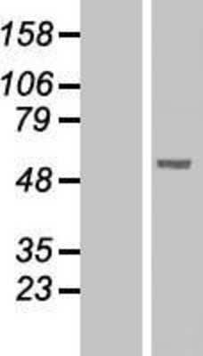 Western Blot: PLRP1 Overexpression Lysate [NBL1-14544]