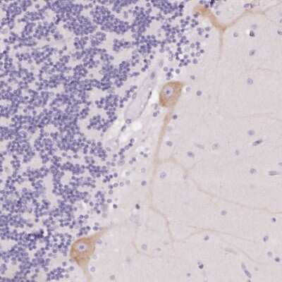 Immunohistochemistry: PNLIPRP3 Antibody [NBP2-49031]