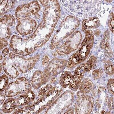 Immunohistochemistry-Paraffin: PNLIPRP3 Antibody [NBP1-94183]