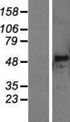 Western Blot: PNLIPRP3 Overexpression Lysate [NBP2-08787]