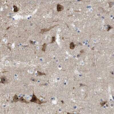 Immunohistochemistry-Paraffin: PNMA-like 1 Antibody [NBP1-87913]