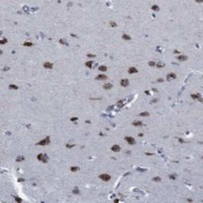 Immunohistochemistry-Paraffin: PNMA-like 1 Antibody [NBP3-17416]