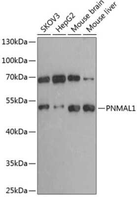 Western Blot: PNMA-like 1 AntibodyBSA Free [NBP2-93770]