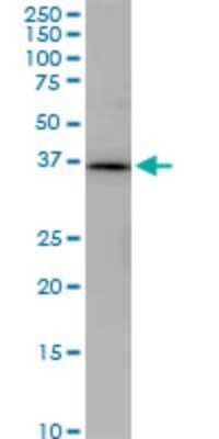 Western Blot: PNMA1 Antibody (1C3) [H00009240-M02]