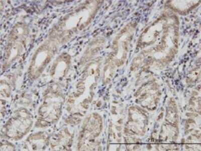 Immunohistochemistry-Paraffin: PNMA1 Antibody (4G6) [H00009240-M01]