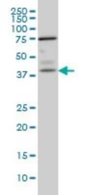 Western Blot: PNMA1 Antibody (4G6) [H00009240-M01]