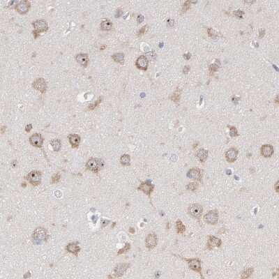 Immunohistochemistry-Paraffin: PNMA1 Antibody [NBP1-82807]