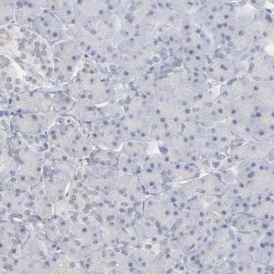 Immunohistochemistry-Paraffin: PNMA1 Antibody [NBP1-82807]