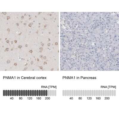 Immunohistochemistry-Paraffin: PNMA1 Antibody [NBP1-82807]