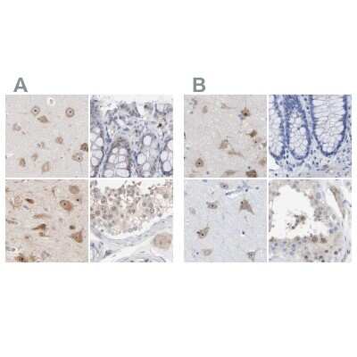 Immunohistochemistry-Paraffin: PNMA1 Antibody [NBP1-82807]