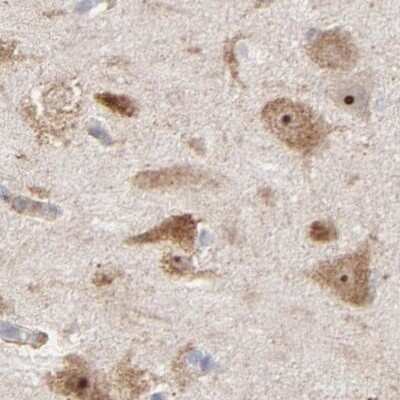 Immunohistochemistry-Paraffin: PNMA1 Antibody [NBP1-82807]
