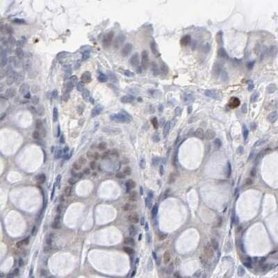 Immunohistochemistry-Paraffin: PNMA1 Antibody [NBP1-82807]