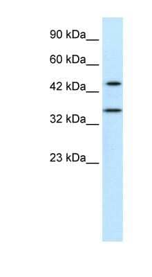 Western Blot: PNMA1 Antibody [NBP1-52935]