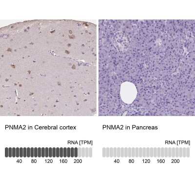 Immunohistochemistry-Paraffin: PNMA2 Antibody [NBP1-82806]