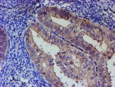 Immunohistochemistry: PNMA3 Antibody (OTI2E6) [NBP2-46460]
