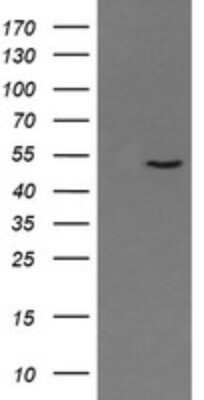 Western Blot: PNMA3 Antibody (OTI2E6) [NBP2-46460]