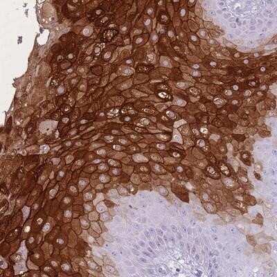 Immunohistochemistry-Paraffin: PNMA3 Antibody [NBP2-13782]