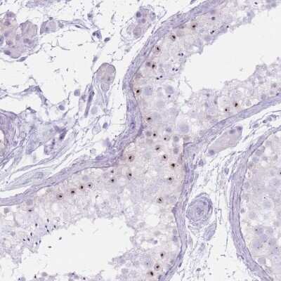 Immunohistochemistry-Paraffin: PNMA3 Antibody [NBP2-13782]