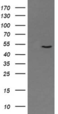 Western Blot: PNMA3 Antibody (OTI2E6)Azide and BSA Free [NBP2-73487]