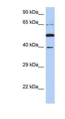 Western Blot: PNMA3 Antibody [NBP1-52929]