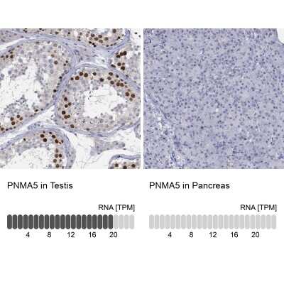 Immunocytochemistry/ Immunofluorescence: PNMA5 Antibody [NBP3-17141]