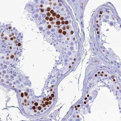 Immunohistochemistry-Paraffin: PNMA5 Antibody [NBP2-13783]