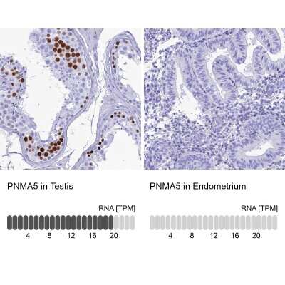 Immunohistochemistry-Paraffin: PNMA5 Antibody [NBP2-13783]