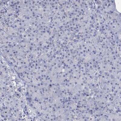 Immunohistochemistry-Paraffin: PNMA5 Antibody [NBP3-17141]