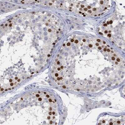 Immunohistochemistry-Paraffin: PNMA5 Antibody [NBP3-17141]