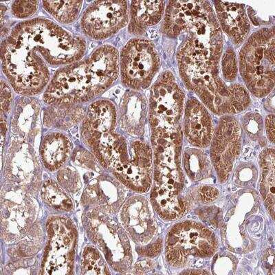 Immunohistochemistry: PNMA6A Antibody [NBP2-46800]