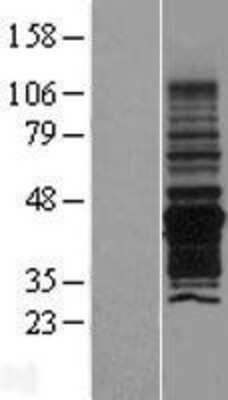 Western Blot: PNMA6A Overexpression Lysate [NBL1-14548]