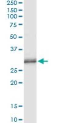 Immunoprecipitation: PNMT Antibody (3G4) [H00005409-M06]