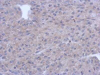 Immunohistochemistry-Paraffin: PNMT Antibody [NBP2-19877]