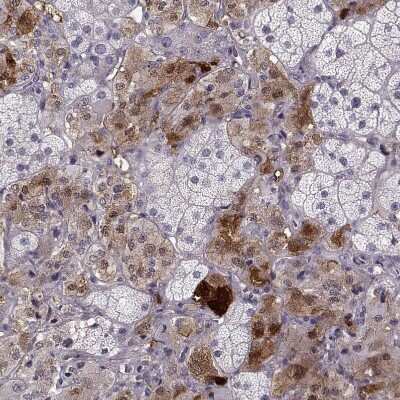 Immunohistochemistry-Paraffin: PNMT Antibody [NBP2-33392]