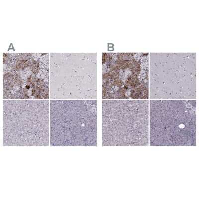 Immunohistochemistry-Paraffin: PNMT Antibody [NBP2-33392]