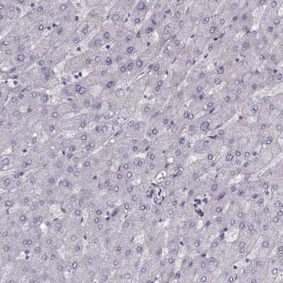 Immunohistochemistry-Paraffin: PNMT Antibody [NBP2-33392]