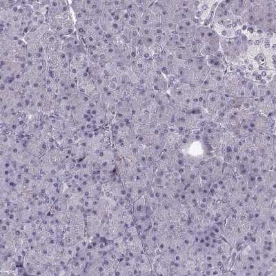Immunohistochemistry-Paraffin: PNMT Antibody [NBP2-33392]