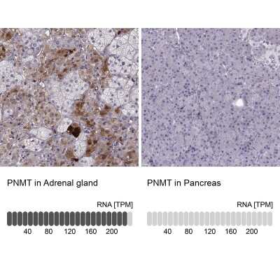 Immunohistochemistry-Paraffin: PNMT Antibody [NBP2-33392]