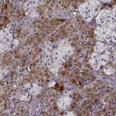 Immunohistochemistry-Paraffin: PNMT Antibody [NBP2-33602]