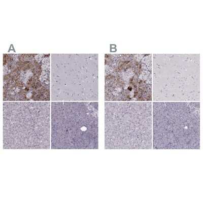 Immunohistochemistry-Paraffin: PNMT Antibody [NBP2-33602]