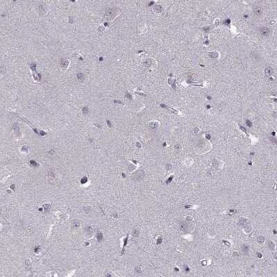 Immunohistochemistry-Paraffin: PNMT Antibody [NBP2-33602]
