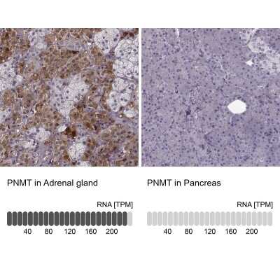 Immunohistochemistry-Paraffin: PNMT Antibody [NBP2-33602]