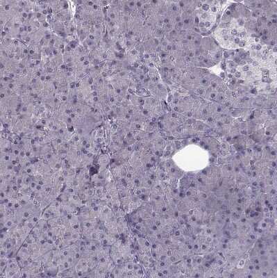 Immunohistochemistry-Paraffin: PNMT Antibody [NBP2-33602]