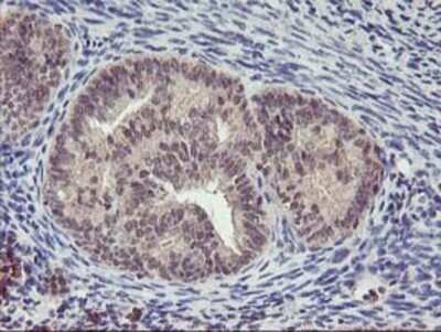 Immunohistochemistry: PNMT Antibody (OTI1D2) - Azide and BSA Free [NBP2-73494]