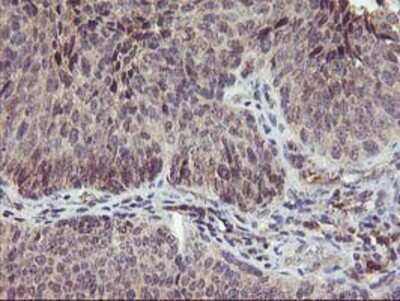Immunohistochemistry: PNMT Antibody (OTI1D2) - Azide and BSA Free [NBP2-73494]