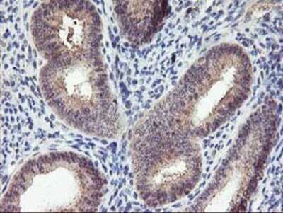 Immunohistochemistry: PNMT Antibody (OTI1D2) - Azide and BSA Free [NBP2-73494]